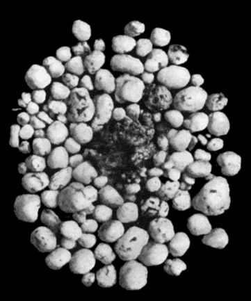 Fig. 168.&mdash;Multiple partially ossified Chondromas of Synovial Membrane, from Shoulder-joint, the seat of arthritis deformans, from a man &aelig;t.&nbsp;35.